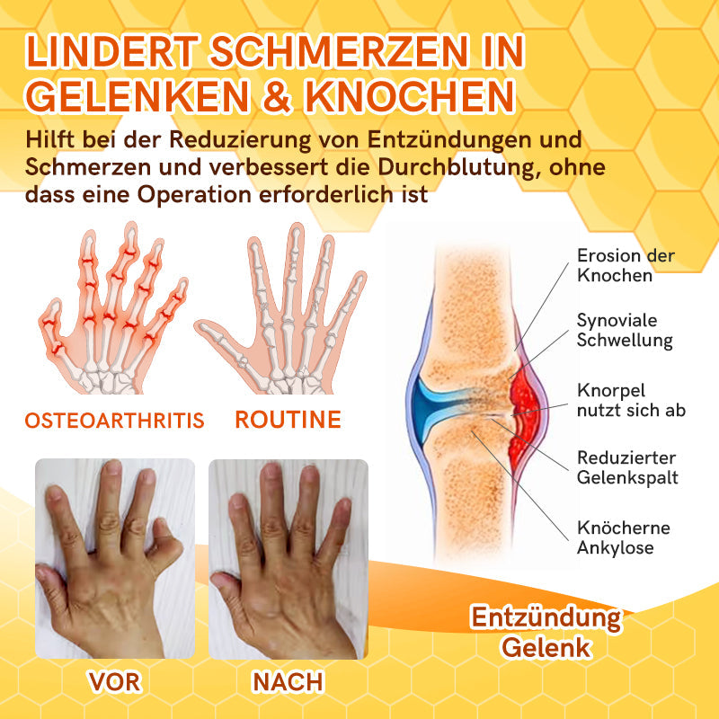 Furzero™ Bienengift Joint Therapy Schmerzlinderungsgel