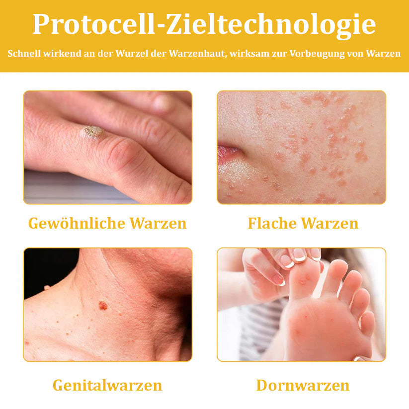 🐝Furzero™ Bienengift-Therapie-Spray(✅Dermatest-Zertifizierung)