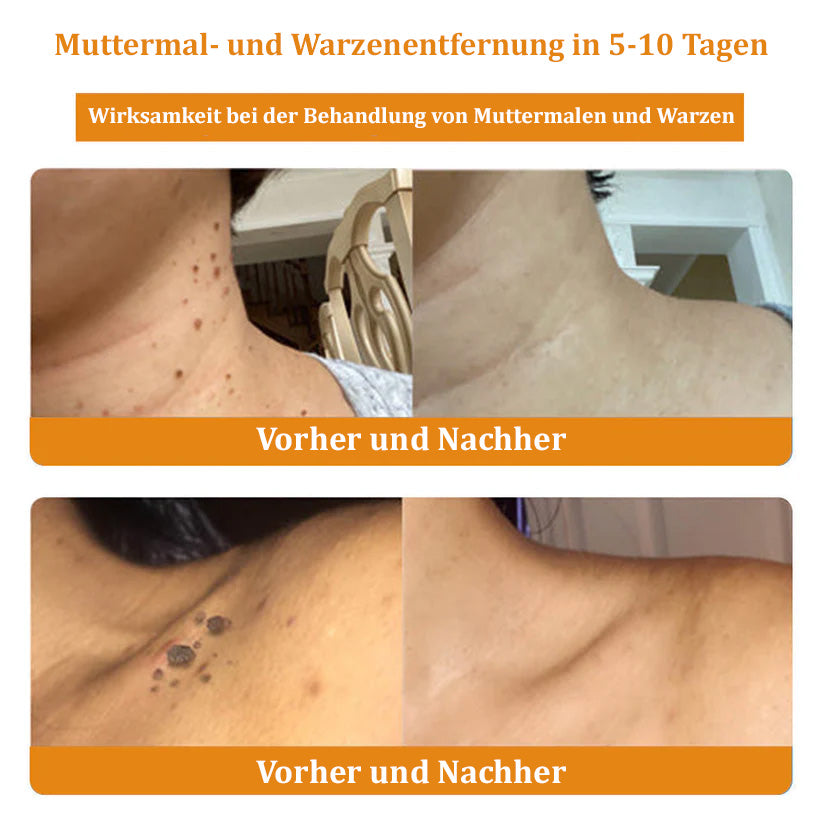 🐝Furzero™ Bienengift-Therapie-Spray(✅Dermatest-Zertifizierung)