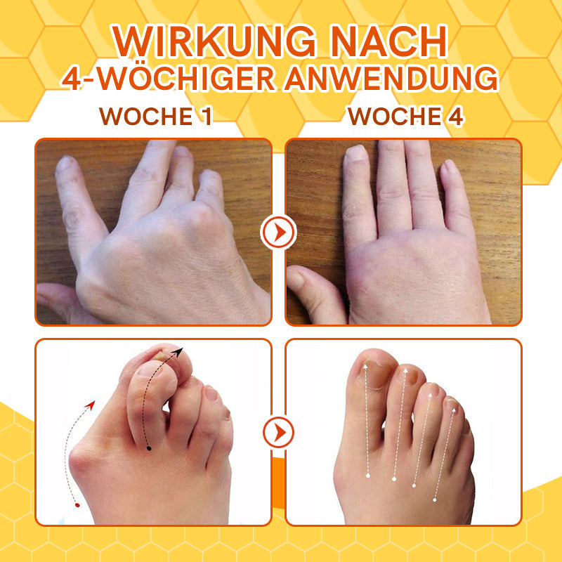 Furzero™ Bienengift Joint Therapy Schmerzlinderungsgel