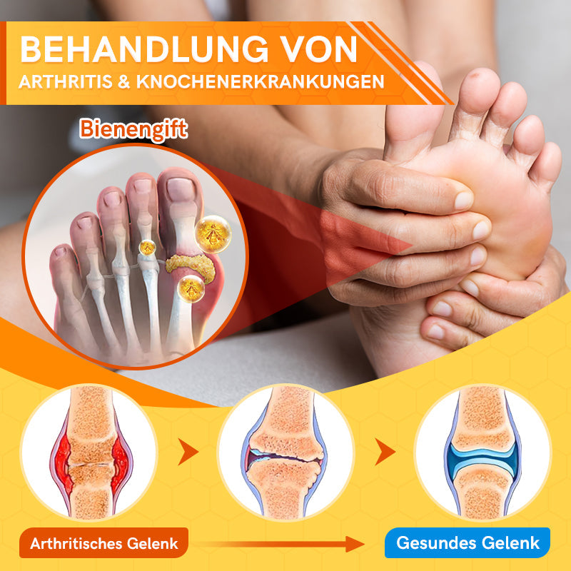 Furzero™ Bienengift Joint Therapy Schmerzlinderungsgel