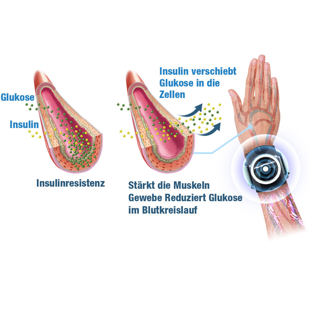 GFOUK™ GlysoWave Elektrisches Impulsgerät