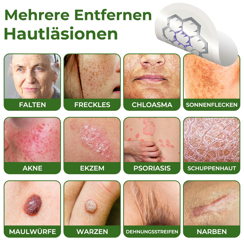 GFOUK® Magnesium MicroNeedle Schnell-Entfernungspflaster für Hautstellen