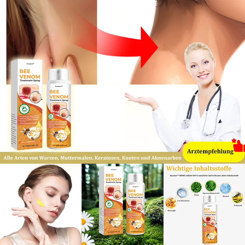 🐝Furzero™ Bienengift-Therapie-Spray(✅Dermatest-Zertifizierung)