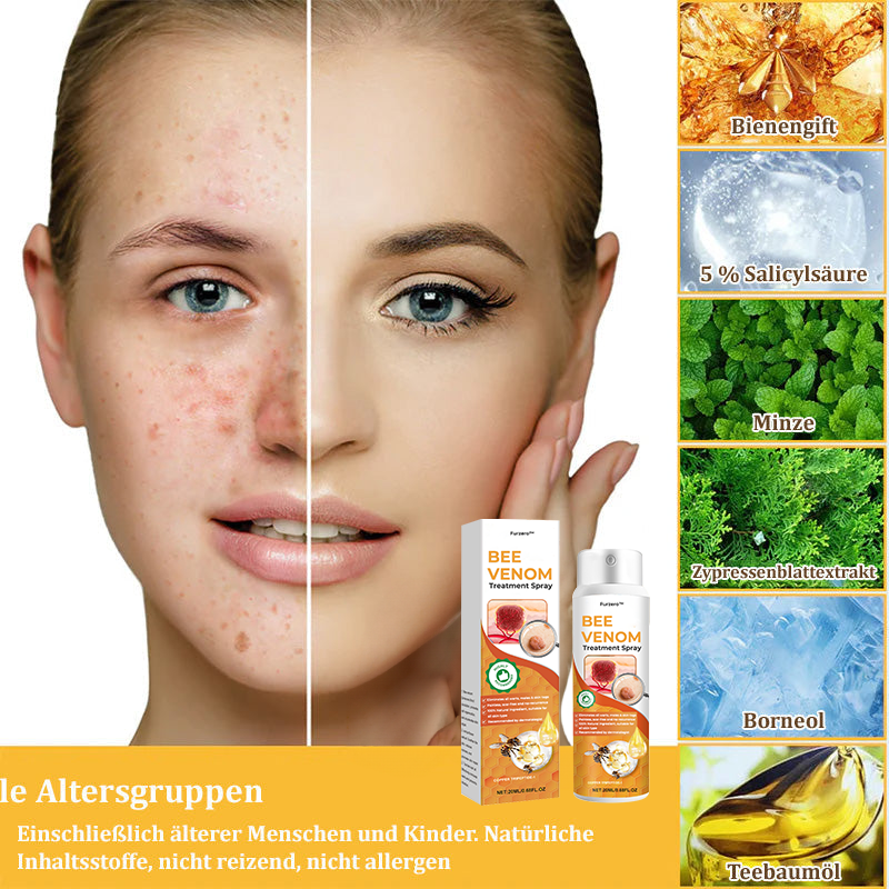 🐝Furzero™ Bienengift-Therapie-Spray(✅Dermatest-Zertifizierung)