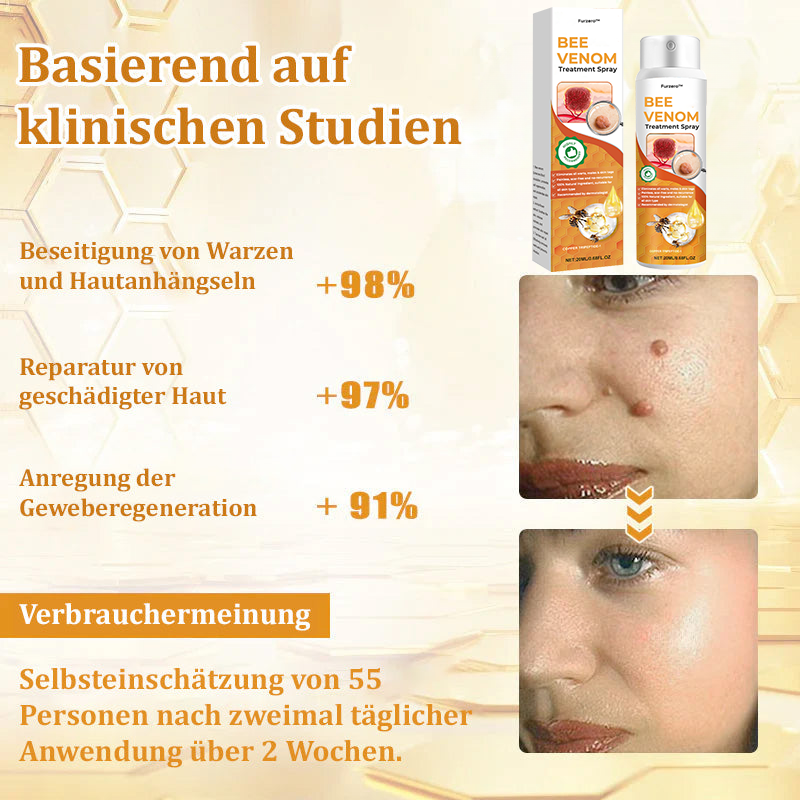 🐝Furzero™ Bienengift-Therapie-Spray(✅Dermatest-Zertifizierung)