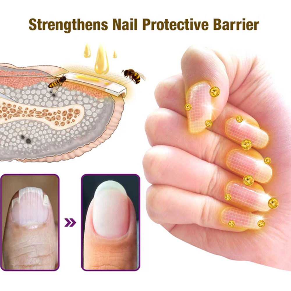 flysmus™ FungiFree Bienengift Nagelbehandlungsserum