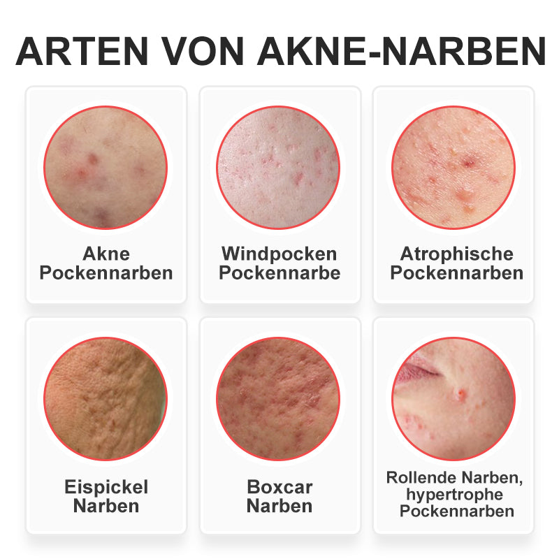 flysmus™ Niacinamid Pockmark Repair Essenz