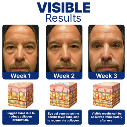 Furzero™ Peptid Ultraschall Augenbehandlung👁️