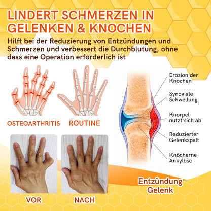 Furzero™ Bienengift Joint Therapy Schmerzlinderungsgel