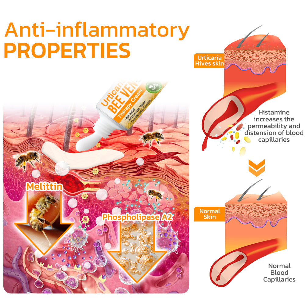 Furzero™ Urtikaria Bienengift Therapie Creme