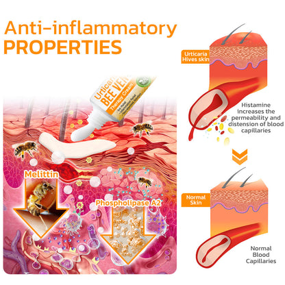 Furzero™ Urtikaria Bienengift Therapie Creme