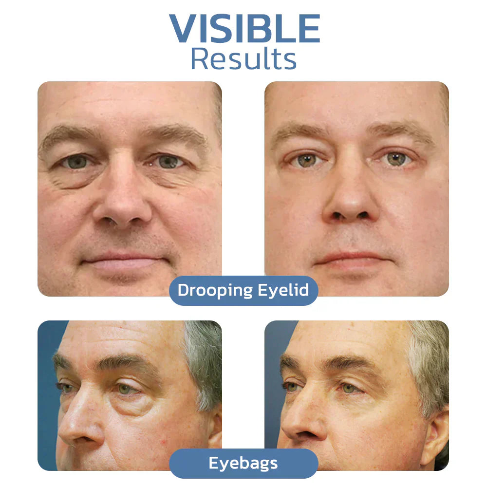🥇Flysmus™ OPENEYES Erwecken Peptid Straffende Auge Gel