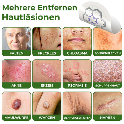 GFOUK® Magnesium MicroNeedle Schnell-Entfernungspflaster für Hautstellen