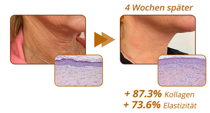 flysmus™ RevitaPeptide Umkehrserum